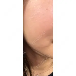 トラスト美容クリニック トラスト美容クリニック 銀座院口コミ