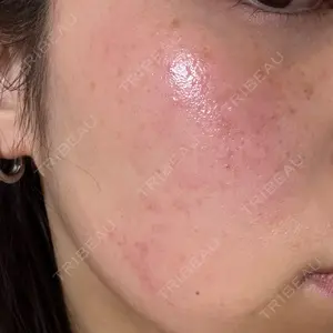 TUNE CLINIC【チューンクリニック】口コミ