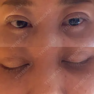 東京シンデレラ美容外科 東京シンデレラ美容外科 池袋院口コミ