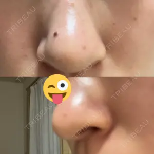 美容皮膚科ティファクリニック 美容皮膚科ティファクリニック 横浜院口コミ
