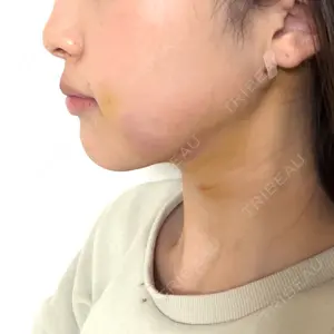 Nebula Clinic 札幌美容外科ネビュラクリニック口コミ