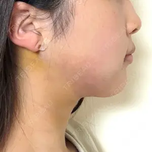 Nebula Clinic 札幌美容外科ネビュラクリニック口コミ