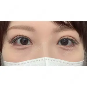 東京シンデレラ美容外科 東京シンデレラ美容外科 池袋院口コミ