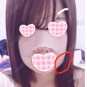 id美容外科の口コミ