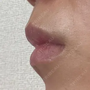 HAAB CLINIC HAAB BEAUTY CLINIC 名古屋院口コミ