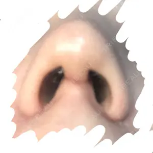 id美容外科の口コミ