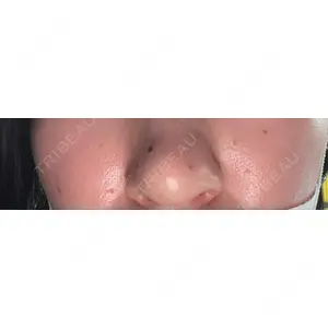 美容皮膚科ティファクリニック 美容皮膚科ティファクリニック 横浜院口コミ