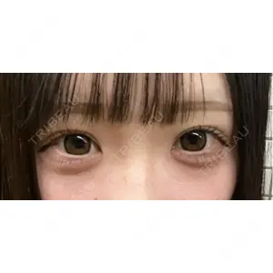 フィラークリニック フィラークリニック 大阪心斎橋院口コミ