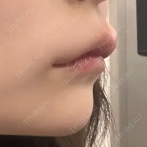 口コミ