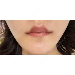 口コミ