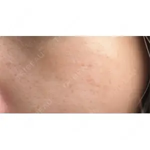 BISIN GINZA CLINIC口コミ