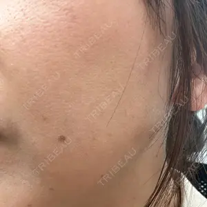 椿クリニック 椿クリニック 名古屋院口コミ
