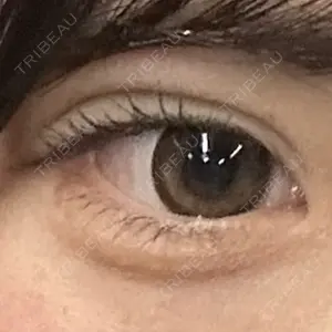 口コミ