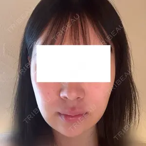 Nebula Clinic 札幌美容外科ネビュラクリニック口コミ