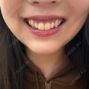 口コミ