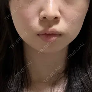 HINATA クリニック口コミ