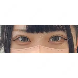 口コミ
