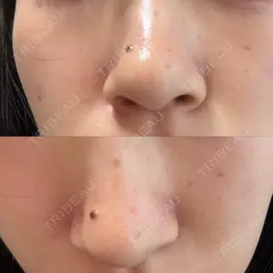 美容皮膚科ティファクリニック 美容皮膚科ティファクリニック 横浜院口コミ