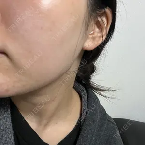 MIO CLINIC 梅田院口コミ