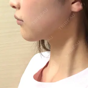Nebula Clinic 札幌美容外科ネビュラクリニック口コミ