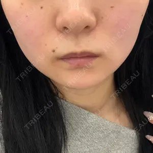 HAAB CLINIC HAAB CLINIC 池袋院口コミ