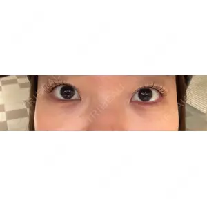 フィラークリニック フィラークリニック 新宿院口コミ