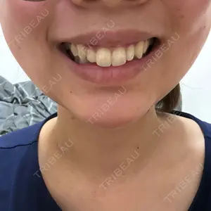 口コミ