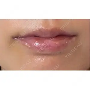 LOUIS CLINIC 二子玉川院【ルイクリニック】口コミ
