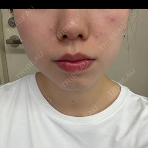 Fellez Clinic【フェルズクリニック】口コミ