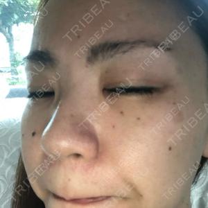 東京美容外科 東京美容外科 沖縄院口コミ