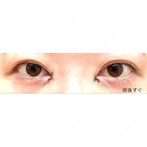 東京イセアクリニック口コミ