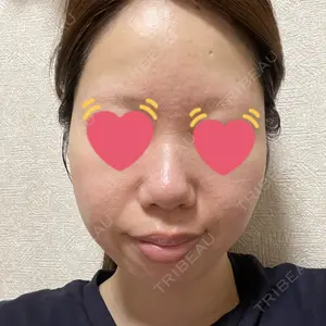 ルラ美容クリニック ルラライト美容クリニック 八王子院口コミ