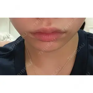 口コミ