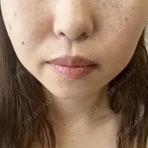ルラ美容クリニック ルラ美容クリニック 渋谷本院口コミ