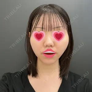 口コミ