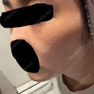 さっぽろ美容クリニック口コミ