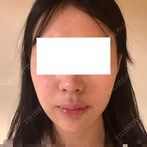 Nebula Clinic 札幌美容外科ネビュラクリニック口コミ