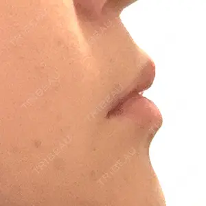 プロクリニック PRO CLINIC プロクリニック 銀座院口コミ