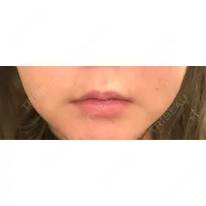プロクリニック PRO CLINIC プロクリニック 銀座院口コミ