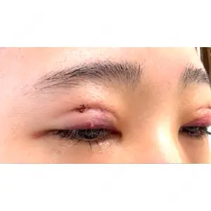 アリエル美容クリニック アリエル美容クリニック 大宮院口コミ