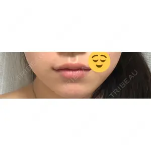 HAAB CLINIC HAAB×DREAM BEAUTY CLINIC 東京本院口コミ