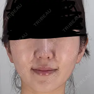 フォンタナクリニック天神口コミ