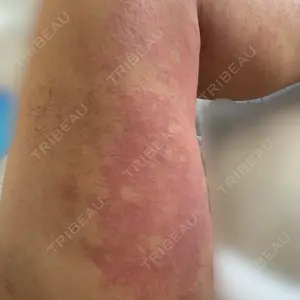 Lipo Clinic omotesando口コミ