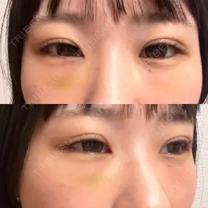 口コミ