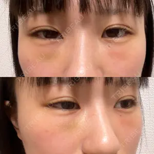口コミ