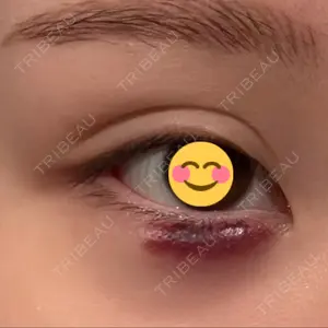 HAAB CLINIC HAAB×DREAM BEAUTY CLINIC 大阪梅田院口コミ