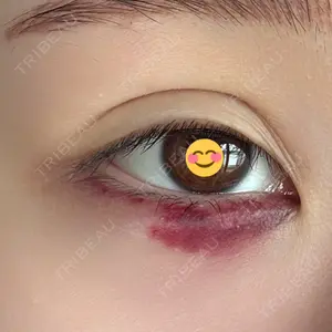 HAAB CLINIC HAAB×DREAM BEAUTY CLINIC 大阪梅田院口コミ