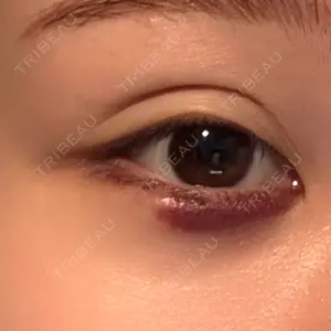 HAAB CLINIC HAAB×DREAM BEAUTY CLINIC 大阪梅田院口コミ