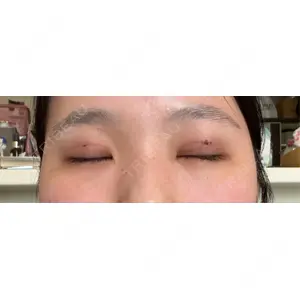 アリエル美容クリニック アリエル美容クリニック 大宮院口コミ