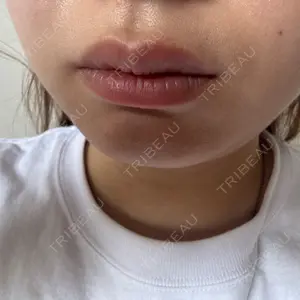 口コミ